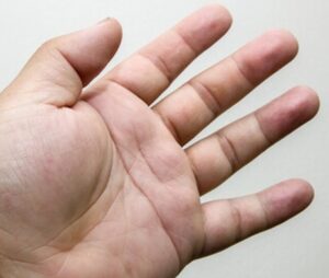 Hand Finger